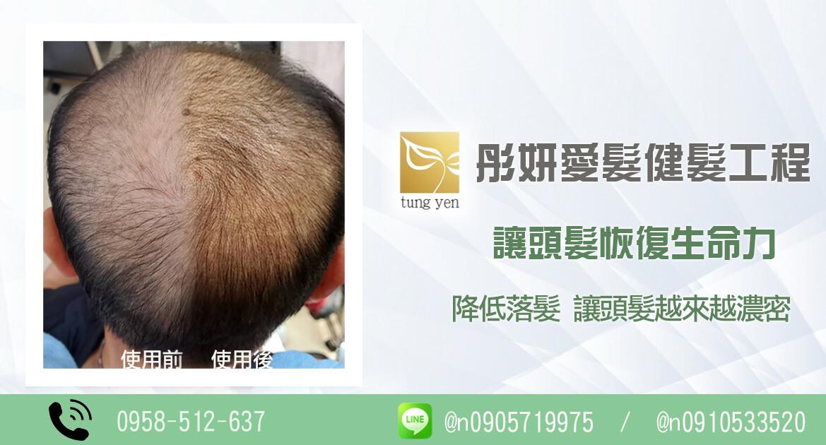 頭皮草.jpg
