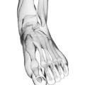 Foot & Ankle
