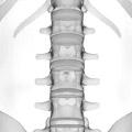 Spine