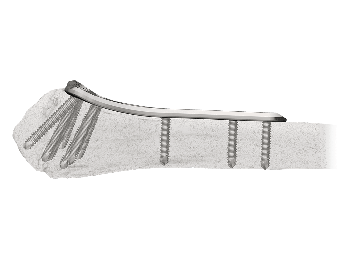 DPR-6.png