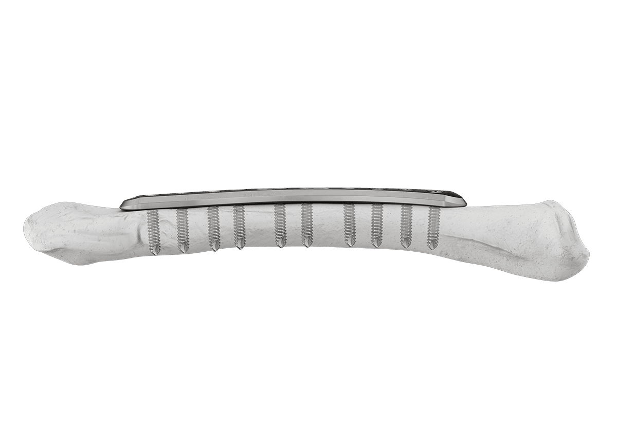 DCM-5.png