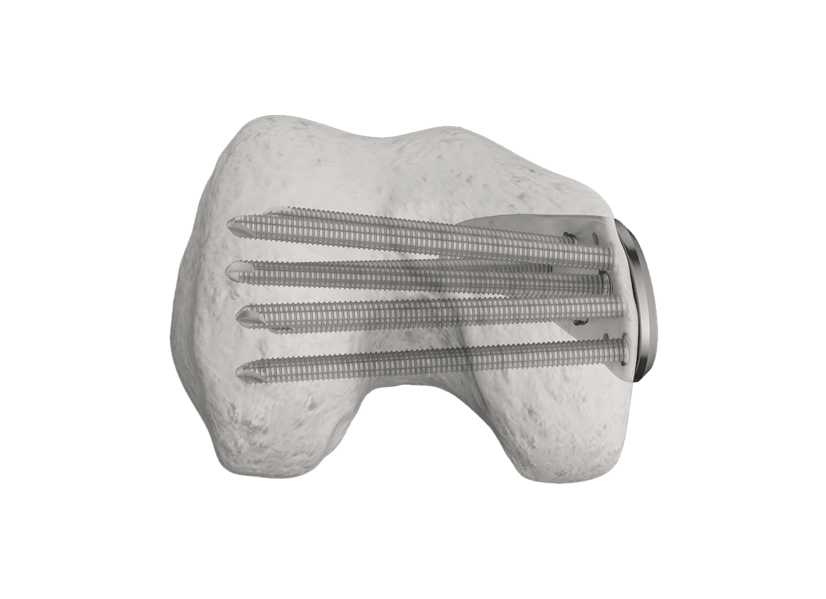 DDLF-7.png