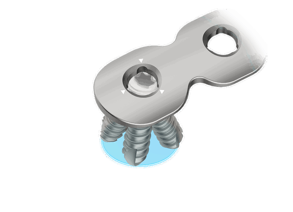 RIFIX 4