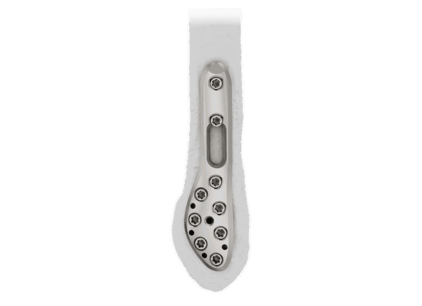 DDF 7