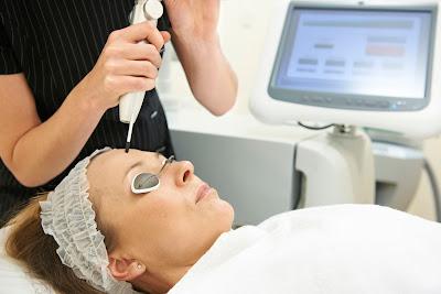 The Low-Down on Whitening