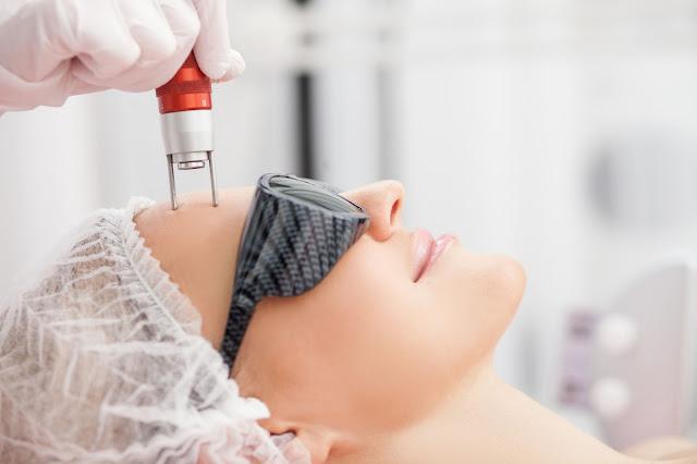 The Showdown: Micro-needling Vs. The Erbium Laser