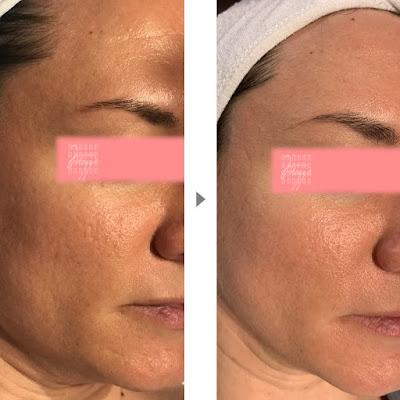 Gloriously Smooth Skin