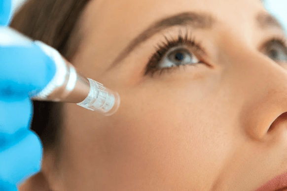 Salmon DNA Microneedling Hawaii