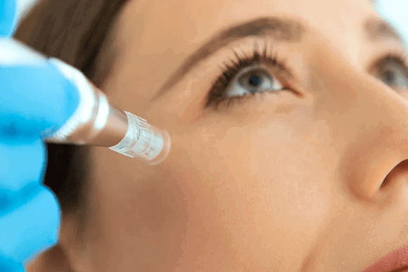 Salmon DNA Microneedling Hawaii