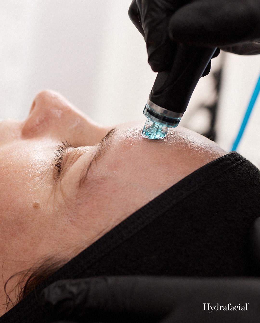 Hydrafacial Treatment Image_ Extraction .jpg