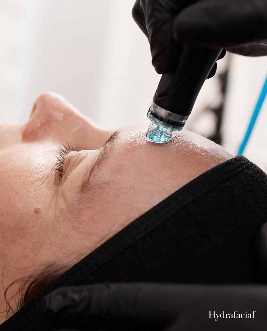 Hydrafacial Treatment Image_ Extraction .jpg