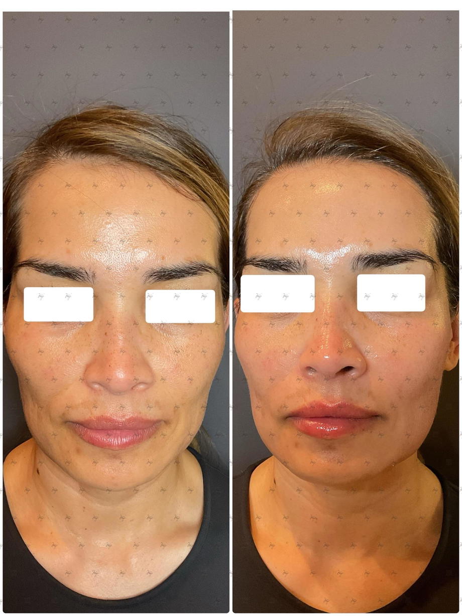 IMG_4688.JPG
